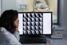Ιστορικό άλμα στη θεραπεία του καρκίνου κεφαλής-τραχήλου με ανοσοθεραπεία