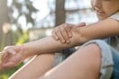 «Γιατί τα κουνούπια τσιμπάνε μόνο εμένα;» - Τι τα έλκει περισσότερο σύμφωνα με έρευνες