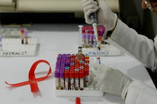 Νέο εμβόλιο κατά του HIV δίνει ελπίδες στους επιστήμονες - Τα πρώτα σημαντικά ευρήματα των δοκιμών