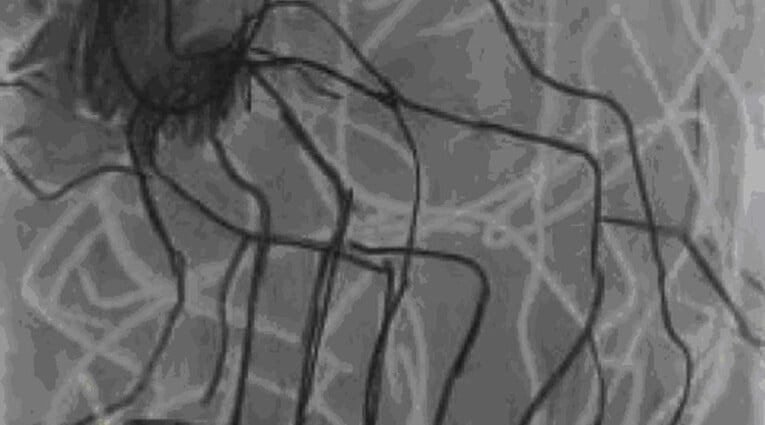 Μάκης Θεοφυλακτόπουλος: Ερωτικά