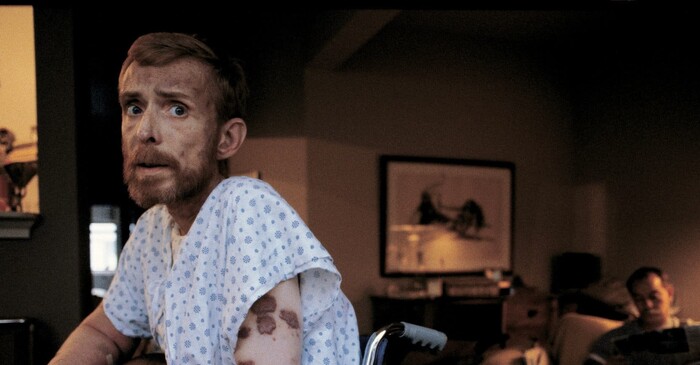 ΠΑΓΚΟΣΜΙΑ ΗΜΕΡΑ AIDS: ΑΥΤΟΙ ΠΟΥ ΔΕΝ ΠΡΟΛΑΒΑΝ