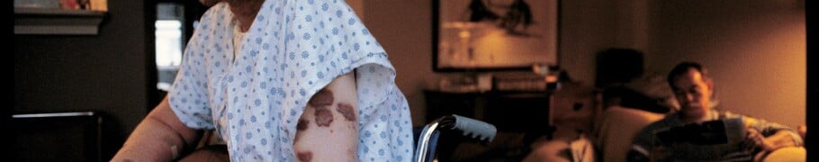 ΠΑΓΚΟΣΜΙΑ ΗΜΕΡΑ AIDS: ΑΥΤΟΙ ΠΟΥ ΔΕΝ ΠΡΟΛΑΒΑΝ