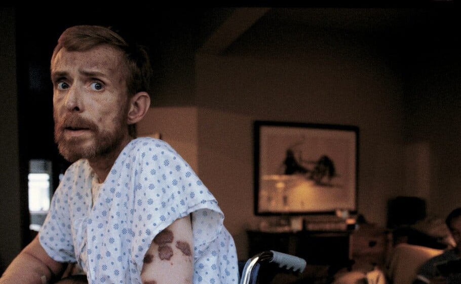 ΠΑΓΚΟΣΜΙΑ ΗΜΕΡΑ AIDS: ΑΥΤΟΙ ΠΟΥ ΔΕΝ ΠΡΟΛΑΒΑΝ