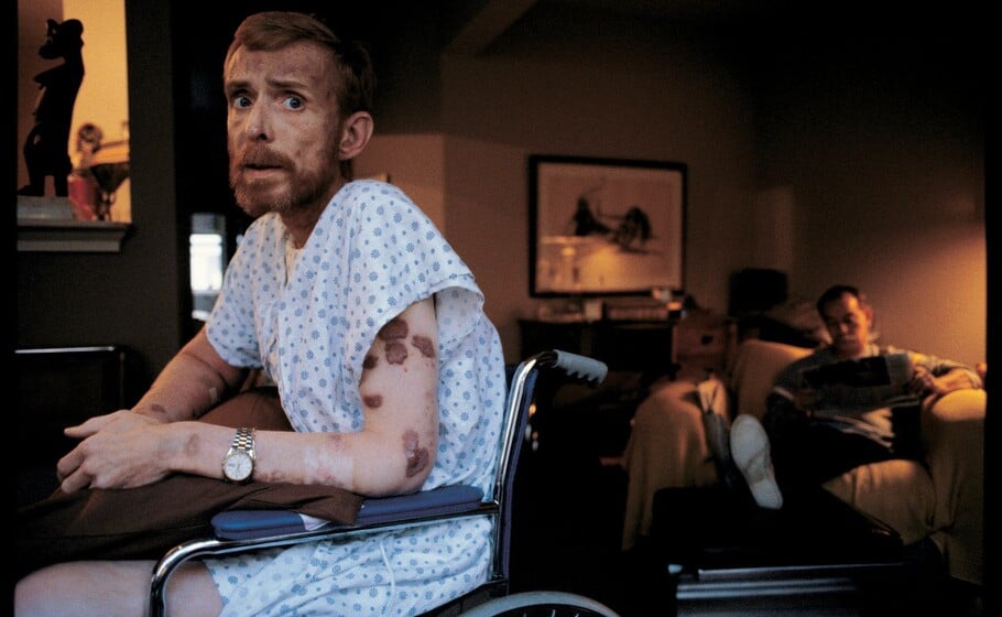 ΠΑΓΚΟΣΜΙΑ ΗΜΕΡΑ AIDS: ΑΥΤΟΙ ΠΟΥ ΔΕΝ ΠΡΟΛΑΒΑΝ