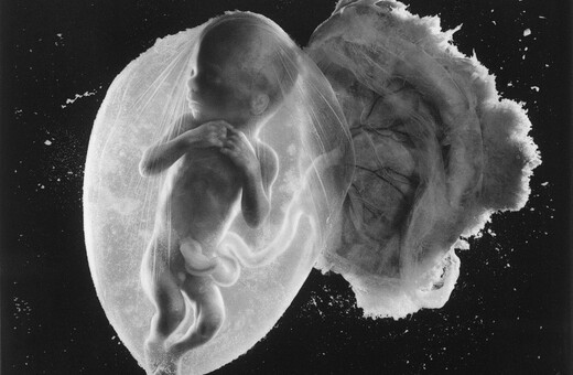 Αυτή είναι η κορυφαία φωτογραφία του περασμένου αιώνα και απεικονίζει ένα έμβρυο 18 εβδομάδων