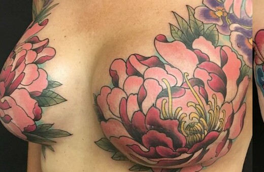 Τατουάζ σε γυναίκες με μαστεκτομή