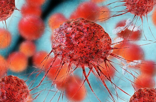 Πόσο κοντά βρισκόμαστε στην πλήρη ίαση του καρκίνου;