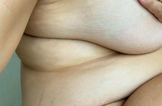 Οι ραγάδες και το αληθινό σώμα της εγκύου Άσλεϊ Γκράχαμ στο Instagram - Η γυμνή φώτο που έλαβε θετικά σχόλια