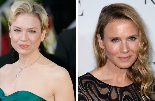 Πώς το πρόσωπο της Renee Zellweger δίχασε το ίντερνετ