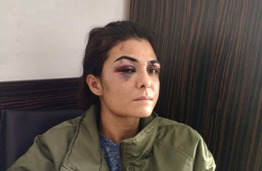 12 χρόνια σκλάβα: η Μελέκ Ιπέκ ως «φάρος» για τις κακοποιημένες γυναίκες στην Τουρκία