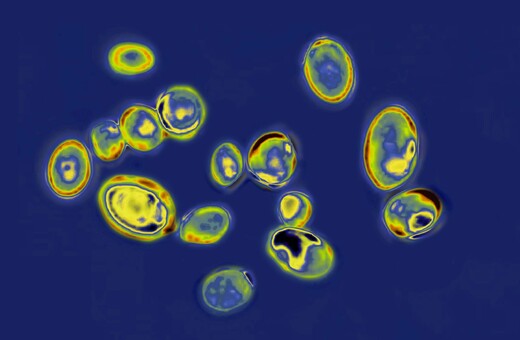 Candida auris: Η «νέα αναδυόμενη παγκόσμια απειλή» - Τι αναφέρει ο Νίκος Σύψας για τον μύκητα