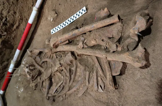 Σκελετός 31.000 ετών χωρίς πόδι αποδεικνύει την παλαιότερη χειρουργική επέμβαση