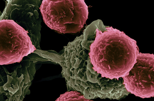 Εντοπίστηκε το «DNA του κακού του Μποντ» - Θα μπορούσε να αλλάξει τη θεραπεία κατά του καρκίνου