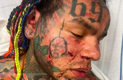 Ο Tekashi 6ix9ine 