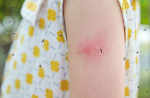 Πώς να γλιτώσετε από τα κουνούπια φέτος το καλοκαίρι. 