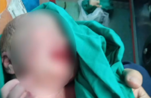 Φωτιά στην Αλεξανδρούπολη: Γέννησε κατά τη διάρκεια της εκκένωσης του νοσοκομείου