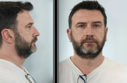 Στη δημοσιότητα οι φωτογραφίες του οδηγού ταξί που έκλεβε και παρέσυρε πελάτες