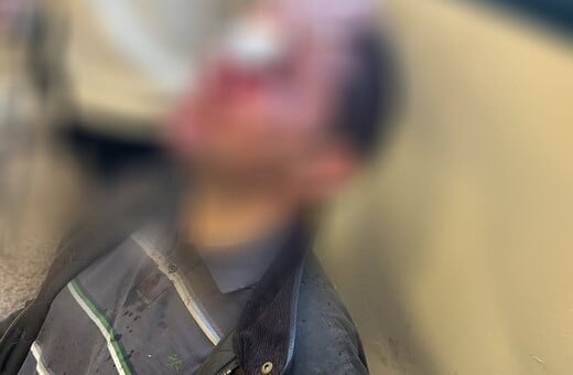 Εισβολή κουκουλοφόρων στη Νομική: Πώς έγινε η επίθεση - «Δεν έχω ξαναδεί τόση βία»