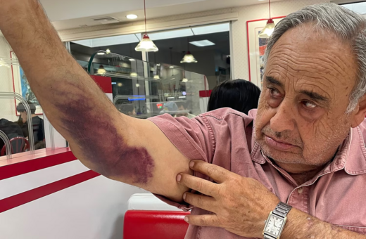 ΗΠΑ: 79χρονος πολίτης καταγγέλλει πράκτορες της ICE για βίαιη επίθεση – Ζητά 50 εκατ. δολάρια