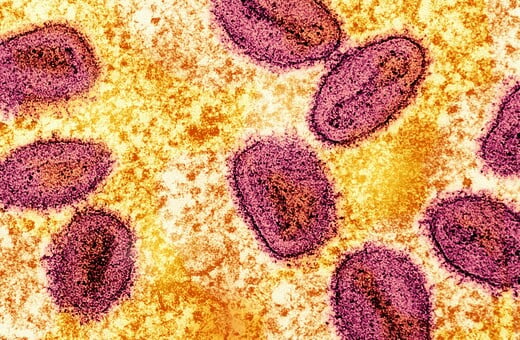 Το πιο επιθετικό στέλεχος της mpox εντοπίστηκε σε κάτοικο της Καλιφόρνια – Χωρίς επαφή με το εξωτερικό