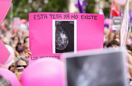 Μαστογραφία Ισπανία Καρκίνος του μαστού Σεβίλλη