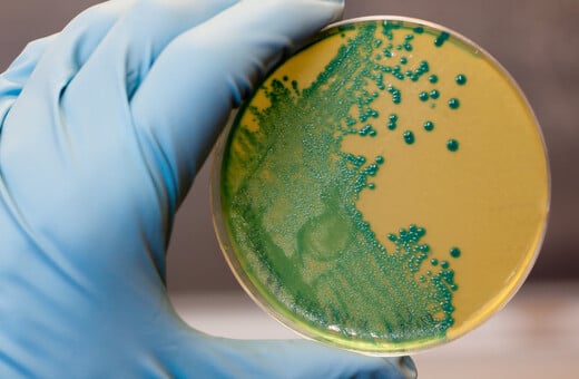 Τι συμβαίνει στις ΗΠΑ με την επιδημία λιστέριας – Ανακαλούνται έτοιμα γεύματα ζυμαρικών