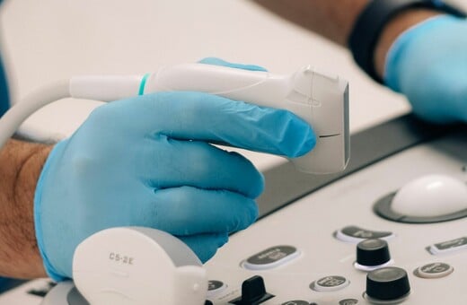 ΓΙΑ Σ/Κ: Πώς ένας απλός υπέρηχος λαιμού μπορεί να εντοπίσει τον κίνδυνο καρδιακής προσβολής και εγκεφαλικού