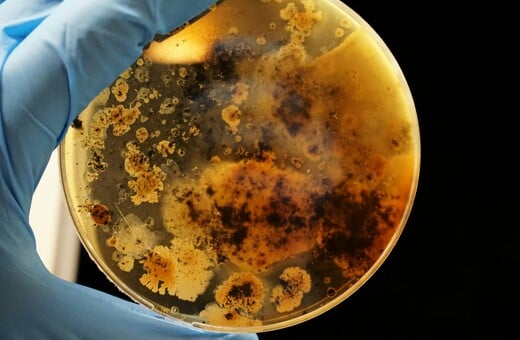 Ευρώπη: Σε άνοδο τροφικές δηλητηριάσεις που συνδέονται με εξαιρετικά ανθεκτικό βακτήριο