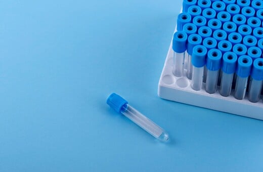 Γιατί δεν εντοπίστηκε το καρκινικό γονίδιο στο σπέρμα δότη που χρησιμοποιήθηκε για τη σύλληψη 197 παιδιών