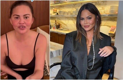 «Μου έπεσε το δόντι» - Το ατύχημα της Κρίσι Τέιγκεν ενώ έπαιζε με τα παιδιά της