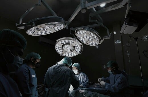 ΚΙΝΑ ΑΥΤΙ ΠΟΔΙ ΜΕΤΑΜΟΣΧΕΥΣΗ