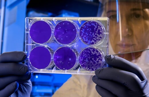 Nipah: Ποια τα συμπτώματα του θανατηφόρου ιού που εξαπλώνεται στην Ινδία