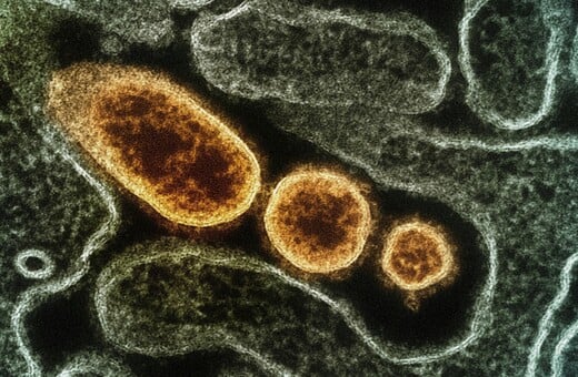 Γρίπη: Δεκάδες κρούσματα στα νοσοκομεία - Κυριαρχεί η υποπαραλλαγή Κ