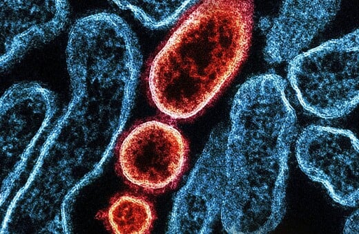 ΙΟΣ ΝΙΠΑ NIPAH 