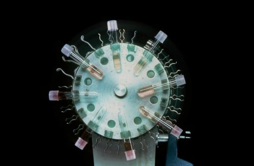 AI εργαλείο αναγνωρίζει fake ή χαμηλής ποιότητας έρευνες για τον καρκίνο