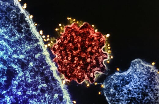 NIPAH ΙΟΣ ΜΠΑΝΓΚΛΑΝΤΕΣ