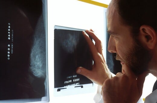 ΤΕΧΝΗΤΗ ΝΟΗΜΟΣΥΝΗ ΜΑΣΤΟΓΡΑΦΙΑ