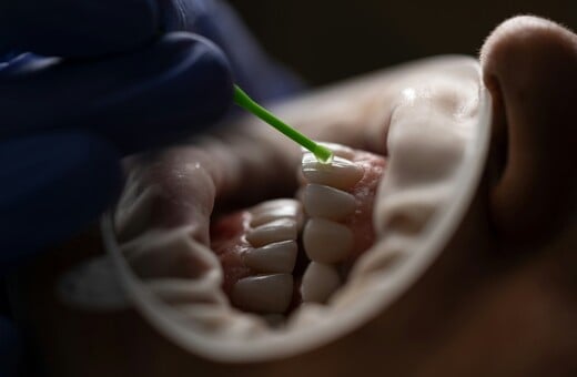 ΛΟΙΜΩΞΗ ΔΟΝΤΙ ΚΑΡΔΙΑ