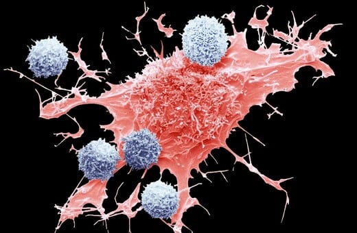 ΚΑΡΚΙΝΟΣ ΠΑΧΕΟΣ ΕΝΤΕΡΟΥ ΤΡΟΦΕΣ