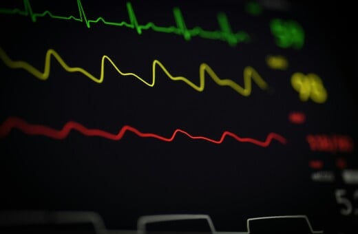 ΚΑΡΔΙΑ ΑΡΡΥΘΜΙΑ ΤΑΧΥΚΑΡΔΙΑ ΕΡΕΥΝΑ