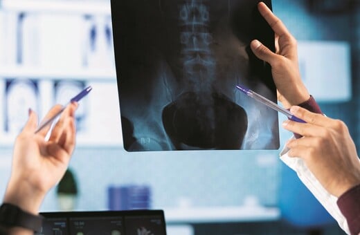 Επανάσταση στην πρόληψη με την προηγμένη μέθοδο που αποκαλύπτει την αληθινή εικόνα του σώματος