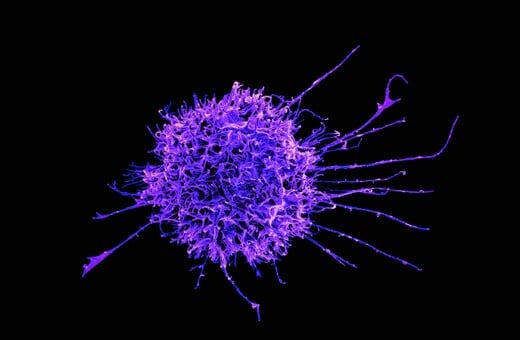 ΕΡΕΥΝΑ ΚΑΡΚΙΝΟΣ ΚΥΤΤΑΡΑ ΓΕΝΕΤΙΚΗ