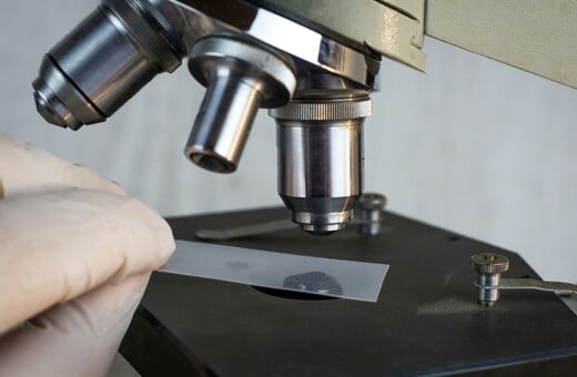 ΟΡΑΣΗ ΘΕΡΑΠΕΙΑ ΒΡΑΒΕΙΑ ΤΥΦΛΩΣΗ ΑΝΑΙΜΙΑ