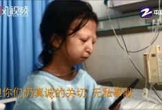 Κίνα: Οργή για το θάνατο φοιτήτριας που ζούσε για πέντε χρόνια τρώγοντας τσίλι και ρύζι - Ζύγιζε 20 κιλά