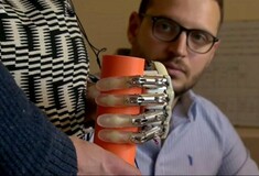 Δημιουργήθηκε το πρώτο βιονικό χέρι με αίσθηση αφής, που μπορεί να φορεθεί εκτός εργαστηρίου