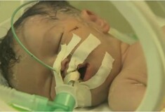 Γάζα: Μωράκι «γεννήθηκε» από την κοιλιά της νεκρής μητέρας του