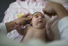 Γεννήθηκε το πρώτο μωρό στην Ευρώπη με μικροκεφαλία από τον Ζίκα