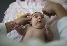 Γεννήθηκε το πρώτο μωρό στην Ευρώπη με μικροκεφαλία από τον Ζίκα