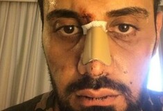 Τουρίστας καταγγέλλει ρατσιστική επίθεση εναντίον του στο Γκάζι - Διαμαρτύρεται για διακρίσεις από τις αρχές