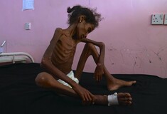 Aυτό είναι το πρόσωπο του πολέμου της Υεμένης